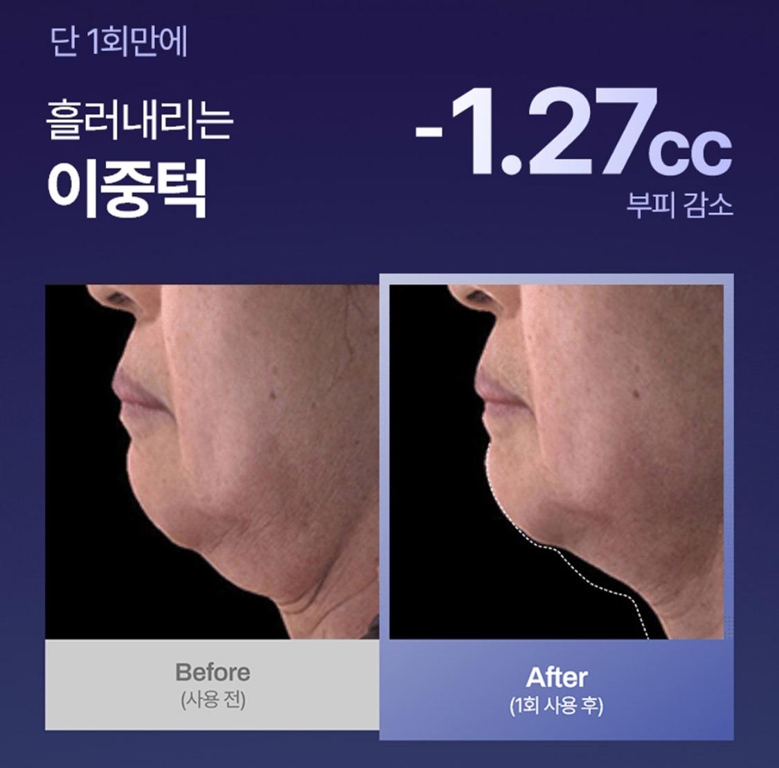 Crema de inyección de péptidos Immotox de Meditherapy